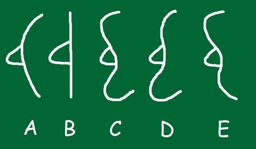 20250410112903.png